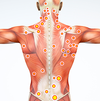what are trigger points in fishers