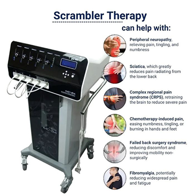 what is scrambler therapy in fishers